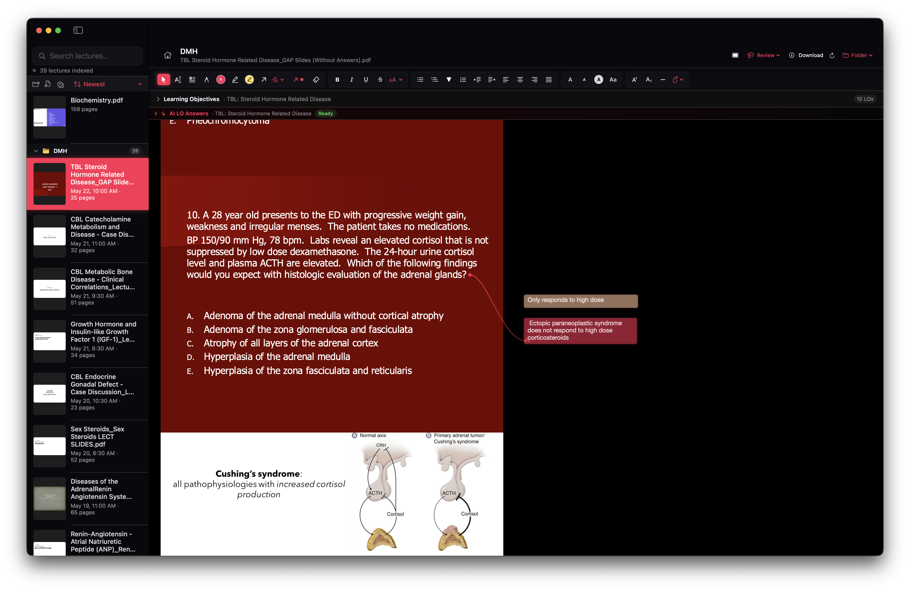 Annotating a lecture slide with margin callouts and highlights in Notes ++